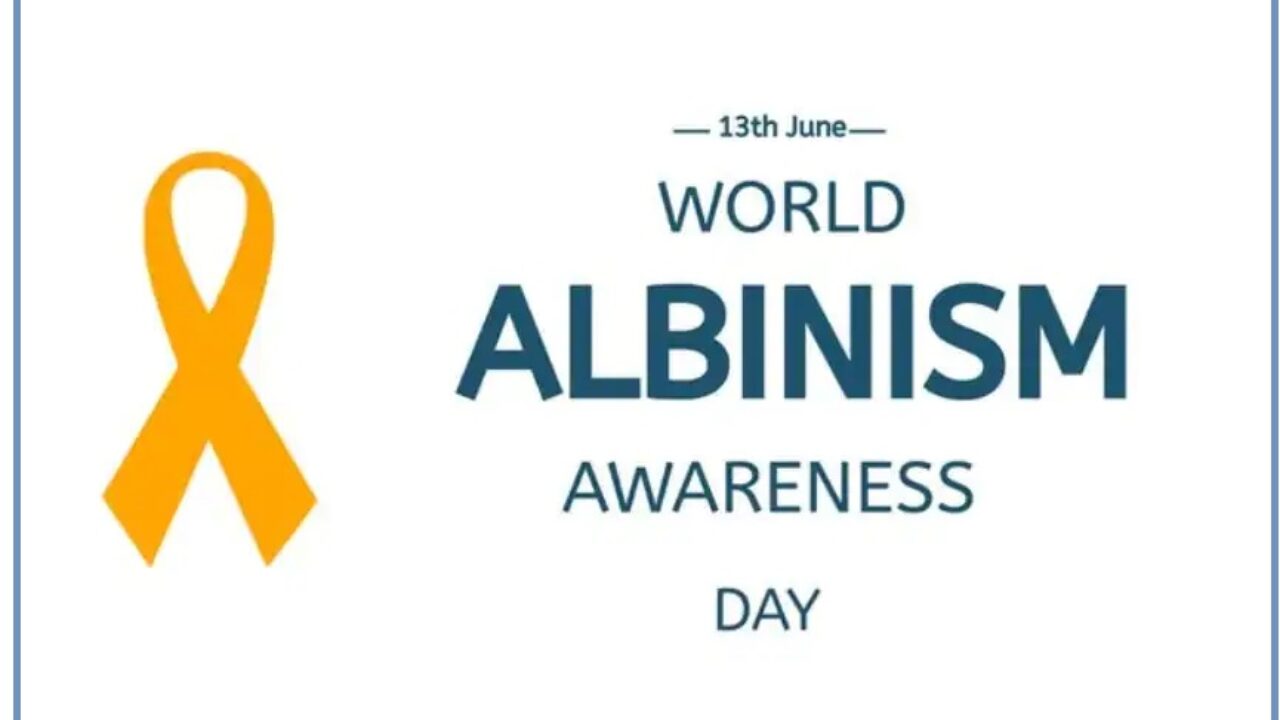 WORLD ALBINISM AWARENESS DAY!!